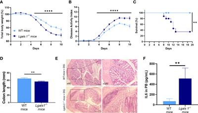 Enhanced Susceptibility of Galectin-1 Deficient Mice to Experimental Colitis